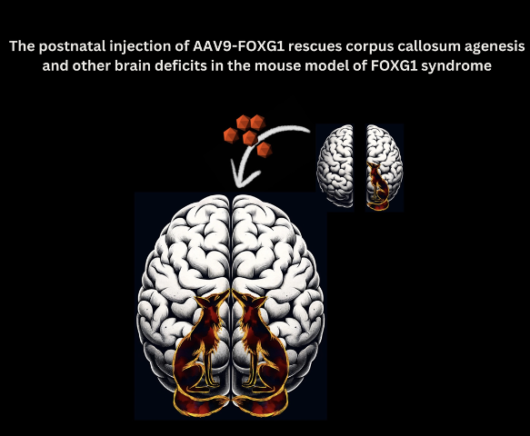Groundbreaking Study Shows Promise in AAV9 Gene Therapy for FOXG1 Syndrome