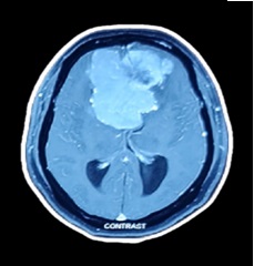 X-Ray of Patient 