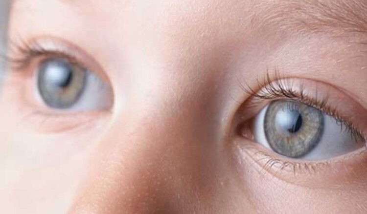 Featured Image Cataract in Children