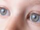 Cataract in Children