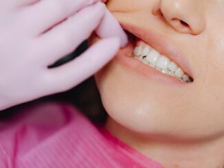 The Science of a Safer Smile: Navigating Professional Teeth Whitening in Singapore