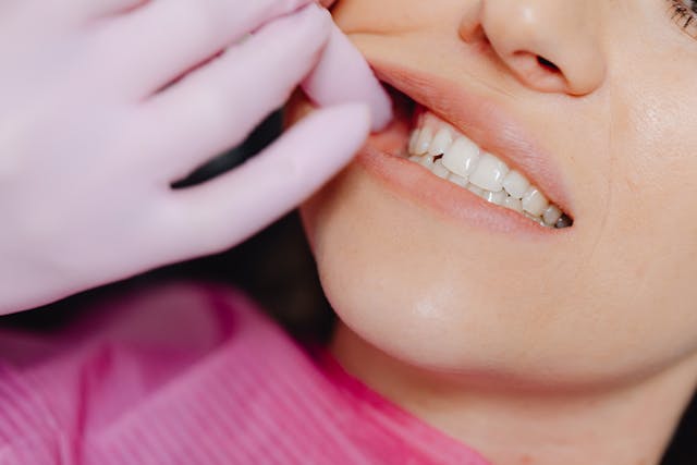 The Science of a Safer Smile: Navigating Professional Teeth Whitening in Singapore