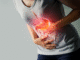stomach cancer